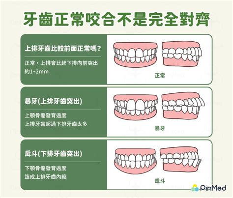 氣場顏色代表 上排牙齒突出正常嗎